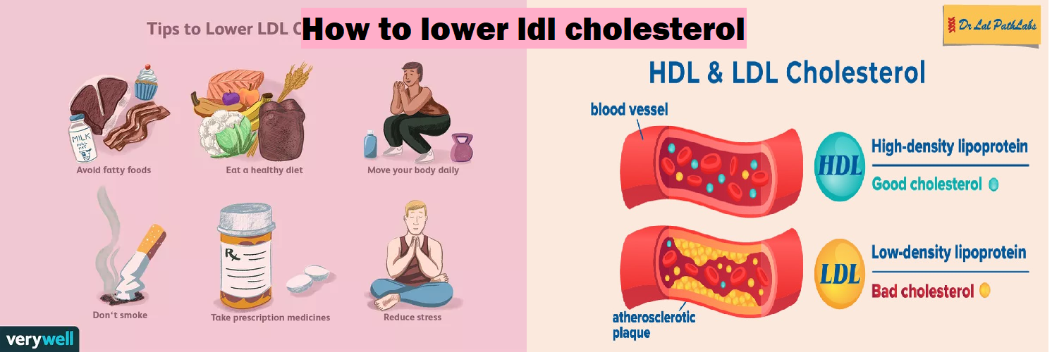 ldl cholesterol