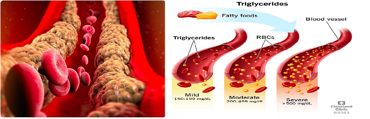 triglycerides